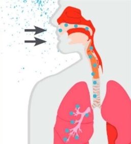 Legionnaires’ disease Legionnaires’ disease